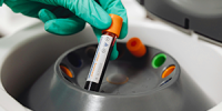 Hématologie Hématologie